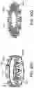 Fig. 87 - Systems and methods for treating a carotid artery