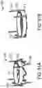 Fig. 88 - Systems and methods for treating a carotid artery
