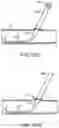Fig. 95 - Systems and methods for treating a carotid artery