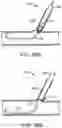 Fig. 97 - Systems and methods for treating a carotid artery