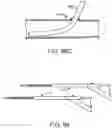 Fig. 98 - Systems and methods for treating a carotid artery