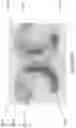 Fig. 50 - Devices and methods for delivering mechanical stimulation to nerve, mechanoreceptor, and cell targets