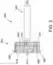 Fig. 04 - Leadless pacemaker with collapsible anchoring device