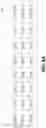 Fig. 10 - Machine learning based artifact rejection for transcranial magnetic stimulation electroencephalogram