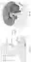 Fig. 08 - WIRELESS NEURAL STIMULATOR WITH INJECTABLE