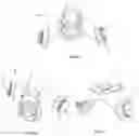 Fig. 02 - Twist And Click Locking Mechanism Of Replaceable Non Symmetrical Filter And Inner Yoke Fitting Part Of Half Mask Face Piece