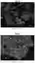 Fig. 18 - Hydrogenation and ethynylation catalysts