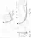 Fig. 17 - Multi-axis articulating and rotary spray system and method