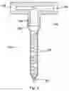 Fig. 04 - Two-component adhesive dispenser with mixing unit replacement system