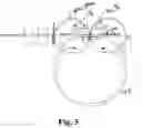 Fig. 04 - APPARATUS AND METHOD FOR PRODUCING SEALING RINGS, ALSO A CONTROL DEVICE AND USE THEREOF FOR THIS PURPOSE, USE OF A ROTATABLY MOUNTED DISC FOR THIS PURPOSE, AND A SEALING RING