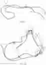 Fig. 07 - Head sling affixable to a chair