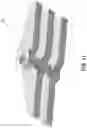 Fig. 18 - Trailer system