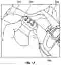 Fig. 02 - Carseat adjustment strap sensor