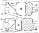 Fig. 01 - Vehicle occupant restraint device and method for operating a vehicle occupant restraint device