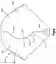 Fig. 23 - Airbag with conical portion