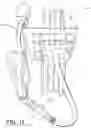 Fig. 09 - Remote filling system