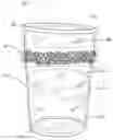 Fig. 01 - METHOD OF TREATING A VESSEL TO ALLOW ADHERENCE OF AN EDIBLE COATING