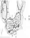 Fig. 14 - MEMS ISOLATION STRUCTURES