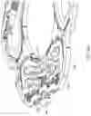 Fig. 15 - MEMS ISOLATION STRUCTURES