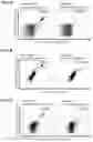 Fig. 25 - Peptides, combination of peptides, and cell based medicaments for use in immunotherapy against urinary bladder cancer and other cancers