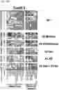 Fig. 34 - Signature-based human immunodeficiency virus (HIV) envelope (Env) trimer vaccines and methods of using the same
