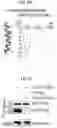 Fig. 25 - HUMAN RESISTIN COMPOSITIONS AND METHODS OF TREATING TLR4-MEDIATED DISEASE AND INFECTION