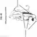 Fig. 101 - Anti-MIC antibodies and methods of use