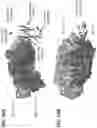 Fig. 77 - Anti-MIC antibodies and methods of use