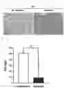 Fig. 03 - Composition for treating fulminant acute pneumonia including CD69 antagonist