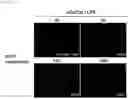 Fig. 05 - Composition for treating fulminant acute pneumonia including CD69 antagonist
