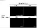 Fig. 06 - Composition for treating fulminant acute pneumonia including CD69 antagonist