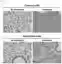 Fig. 10 - Composition for treating fulminant acute pneumonia including CD69 antagonist