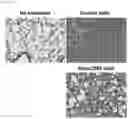 Fig. 13 - Composition for treating fulminant acute pneumonia including CD69 antagonist