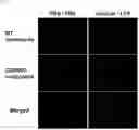 Fig. 14 - Composition for treating fulminant acute pneumonia including CD69 antagonist