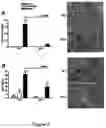 Fig. 03 - REGULATING IL-4 AND IL-13 LEVELS BY BLOCKING HIGH AFFINITY BINDING BY IL-3, IL-5 AND GM-CSF TO THEIR COMMON RECEPTOR