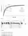 Fig. 07 - Antibody specifically binding to PAUF protein and use thereof