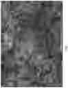 Fig. 03 - Macroporous beads