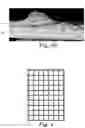 Fig. 05 - MICROBIAL DETECTION DEVICES AND METHODS OF USING THE SAME