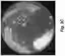 Fig. 06 - ENGINEERED COMMENSAL BACTERIA AND METHODS OF USE