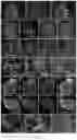 Fig. 31 - Method of producing naive pluripotent stem cells