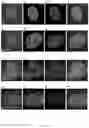 Fig. 34 - Method of producing naive pluripotent stem cells
