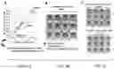 Fig. 03 - Agents and methods for treating and preventing seborrheic keratosis