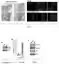 Fig. 05 - Agents and methods for treating and preventing seborrheic keratosis