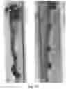 Fig. 14 - Redirected, genetically-engineered T regulatory cells and their use in suppression of autoimmune and inflammatory disease