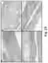 Fig. 22 - Redirected, genetically-engineered T regulatory cells and their use in suppression of autoimmune and inflammatory disease