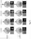 Fig. 27 - Redirected, genetically-engineered T regulatory cells and their use in suppression of autoimmune and inflammatory disease
