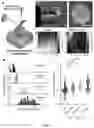 Fig. 04 - LIVER ORGANOID DISEASE MODELS AND METHODS OF MAKING AND USING SAME