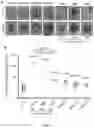 Fig. 05 - LIVER ORGANOID DISEASE MODELS AND METHODS OF MAKING AND USING SAME