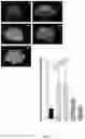Fig. 10 - LIVER ORGANOID DISEASE MODELS AND METHODS OF MAKING AND USING SAME