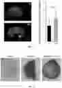 Fig. 15 - LIVER ORGANOID DISEASE MODELS AND METHODS OF MAKING AND USING SAME